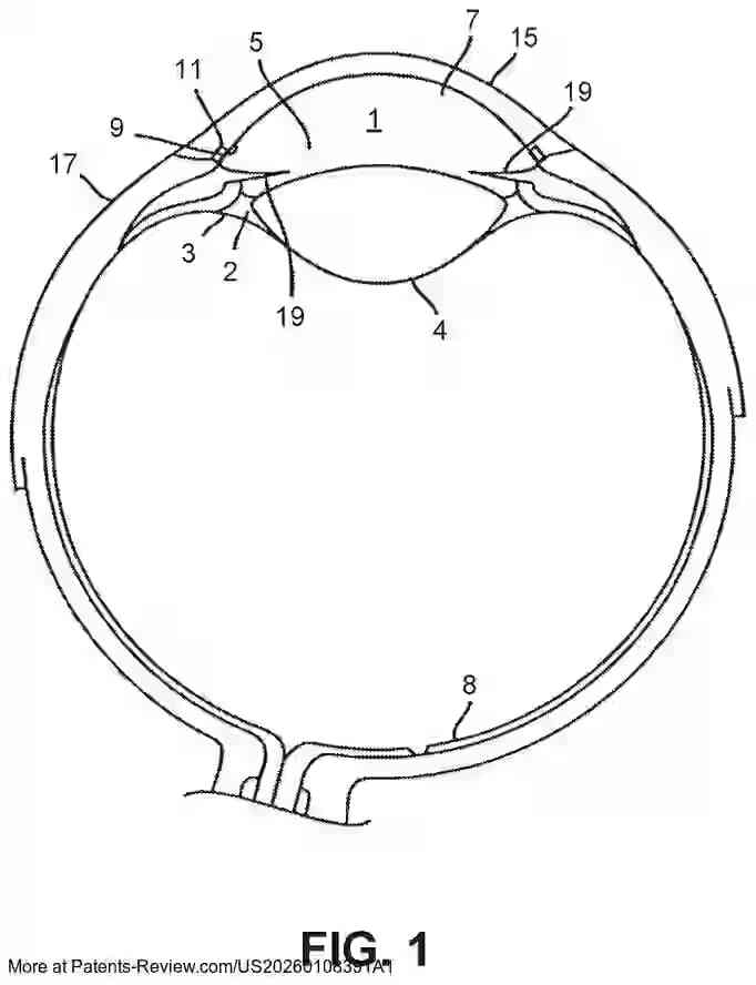 Drawing 02 for SYSTEMS AND METHODS FOR A COMBINED EXCIMER LASER AND PHACOEMULSIFICATION UNIT