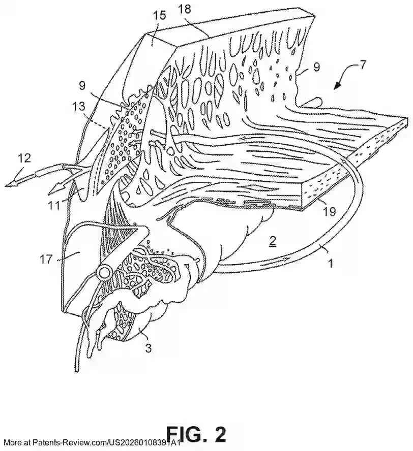 Drawing 03 for SYSTEMS AND METHODS FOR A COMBINED EXCIMER LASER AND PHACOEMULSIFICATION UNIT