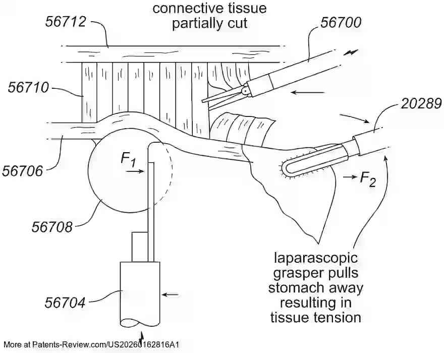 Drawing 01 for ADAPTIVE RETRACTION FORCE CONTROL